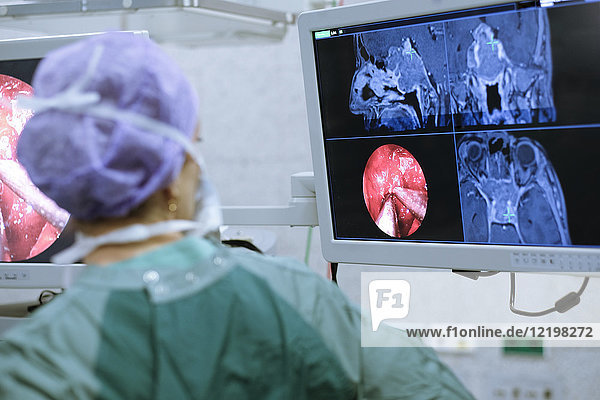 Neurochirurg in Peelings mit Blick auf den Monitor