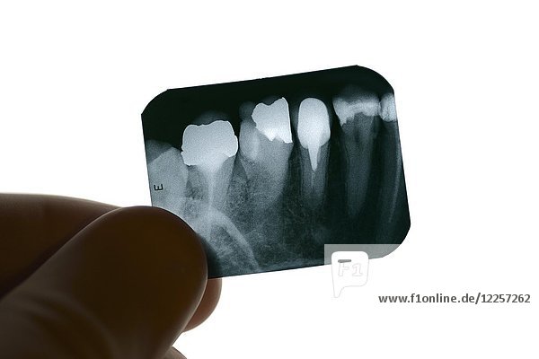 Zahnröntgenbild bei der Untersuchung durch einen Zahnarzt