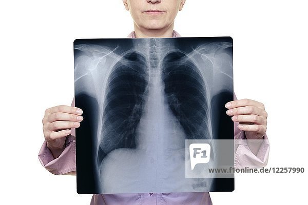 Frau hält eine Röntgenaufnahme der Brust vor ihren Körper