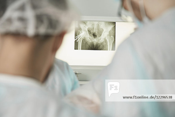 Operationsteam gegen medizinisches Röntgen am Bildschirm im Operationssaal