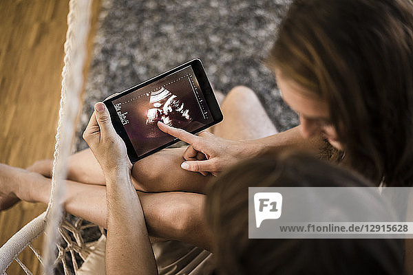 Couple looking at ultrasound scan on tablet