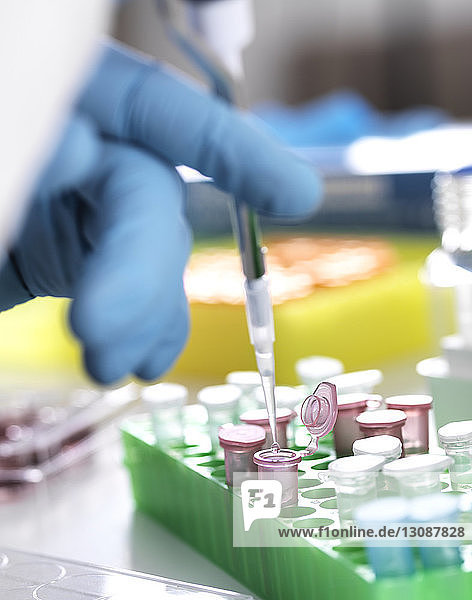 Geschnittene Hand eines Wissenschaftlers pipettiert im Labor Probe in Eppendorf-Fläschchen