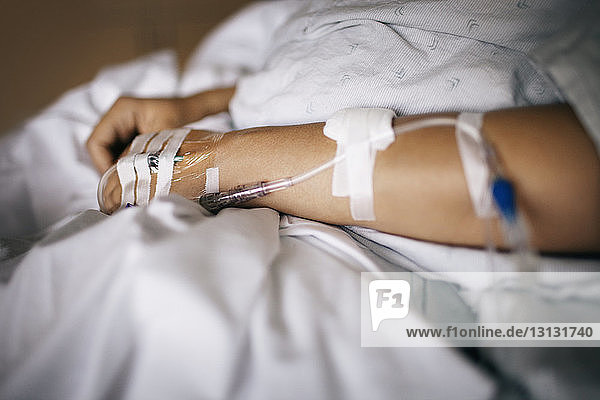 IV drips attached to woman's hand in hospital