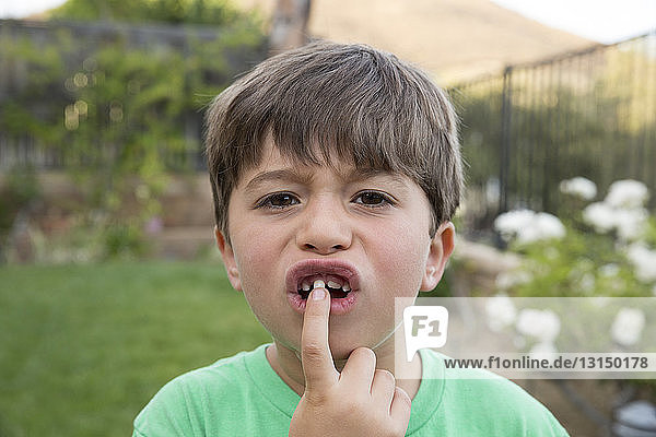 Portrait of young boy  wobbling front tooth