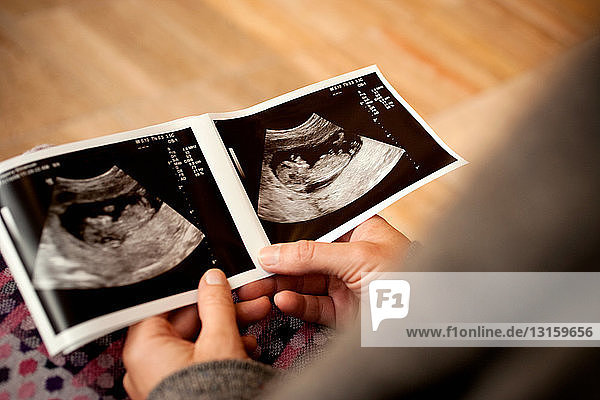 Woman holding ultrasound scan photograph