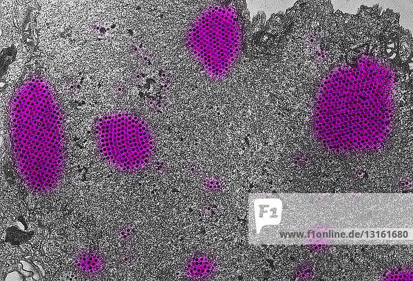 Light micrograph of canine adenovirus type iia