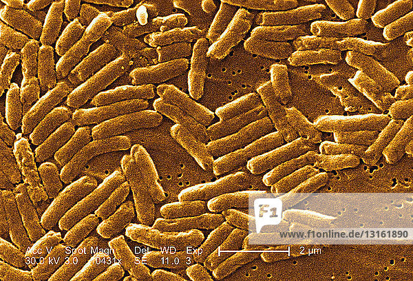 SEM of rod-shaped Salmonella bacteria