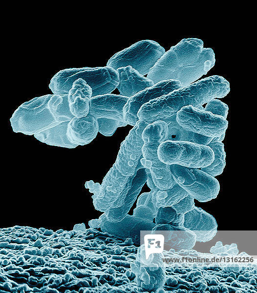 SEM eines Clusters von E. coli-Bakterien