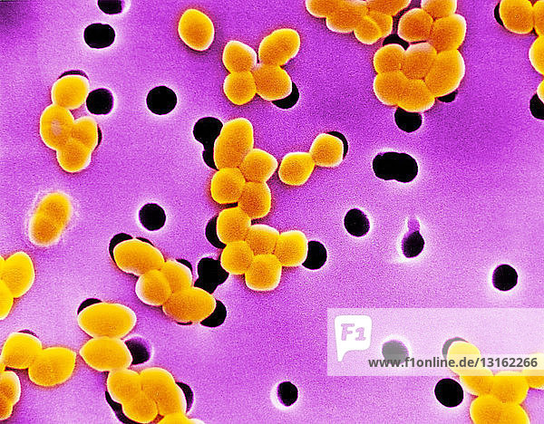 SEM von grampositiven Enterokokken-Bakterien