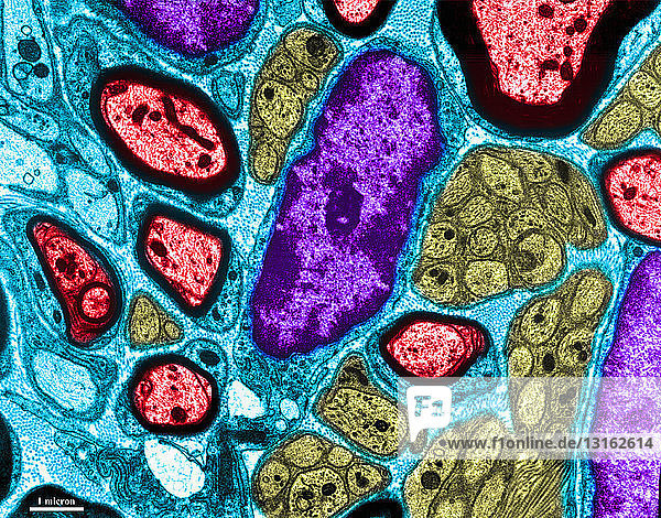 TEM of nerve in mouse lung