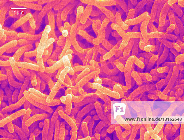 Rasterelektronenmikroskopische Aufnahme von Cholera-Bakterien