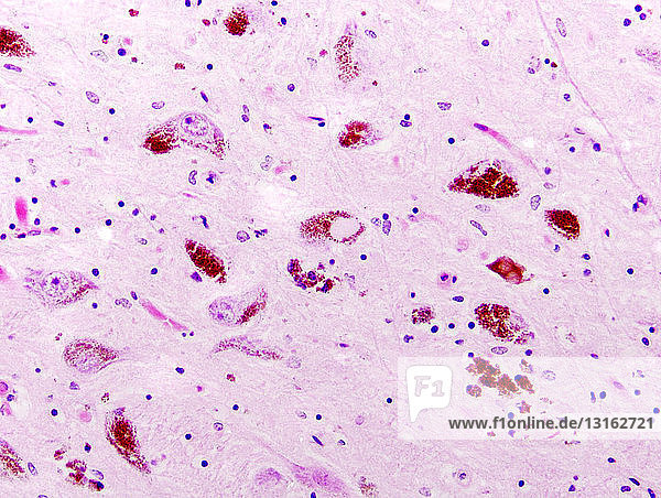 Anschnitt,Ausschnitt,Biologie,Close-up,Demenz,Detail