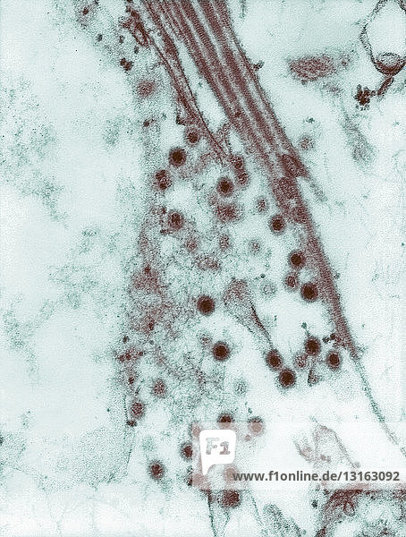 TEM of Colorado tick fever virus (CTFV)