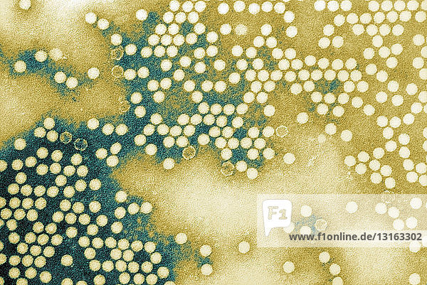 TEM of poliovirus type 1