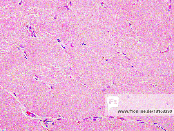 Normaler Muskel