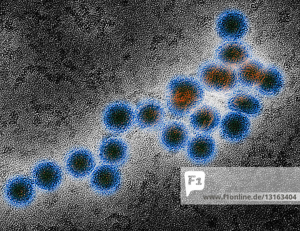 EM of West Nile virus