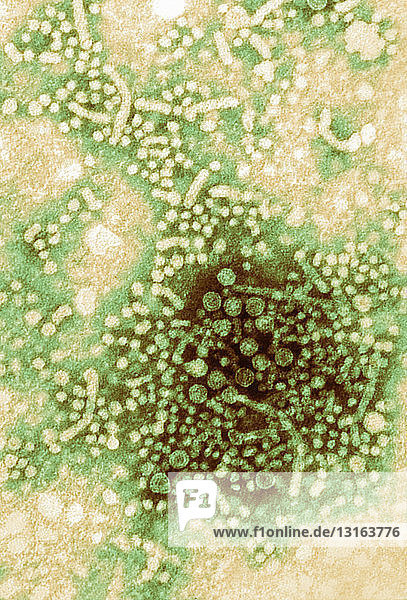 TEM mit Partikeln des Hepatitis-B-Virus