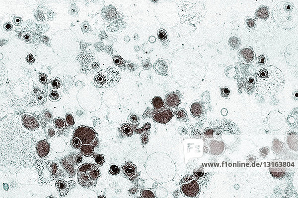 Electron microscope image of cytomegalovirus