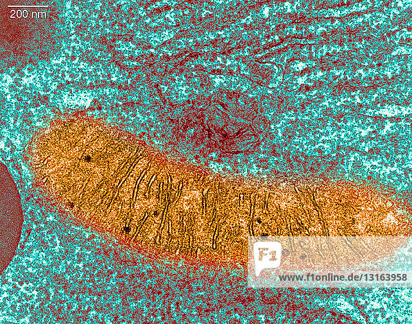 Transmission Electron micrograph pancreas