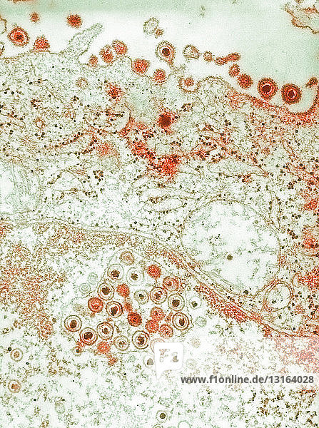 TEM showing herpes simplex virions