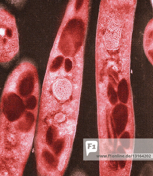 Electron micrograph of Bacillus anthracis bacteria