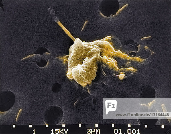 SEM of death of a Cancer Cell (6 step sequence)