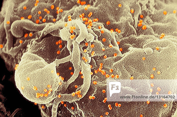 Rasterelektronenmikroskopische Aufnahme des aufkeimenden HIV-Virus