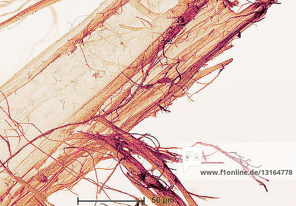 Scanning Electron micrograph of asbestos