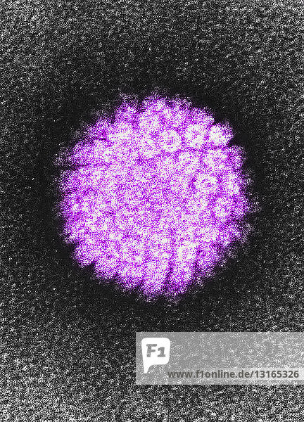 EM of a human papilloma virus (HBV)