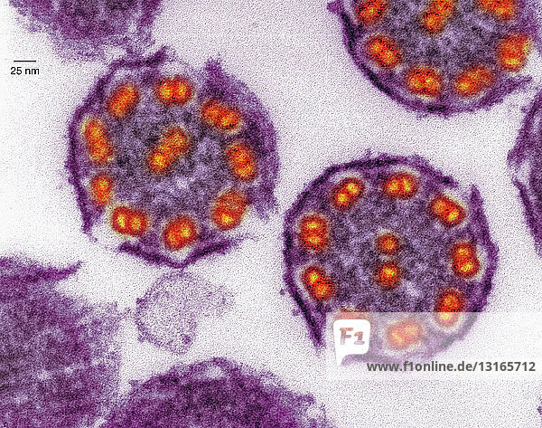 TEM of mammalian lung tissue