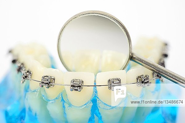 Zahnhygiene  Zahnersatz mit fester Zahnspange und ein Zahnspiegel