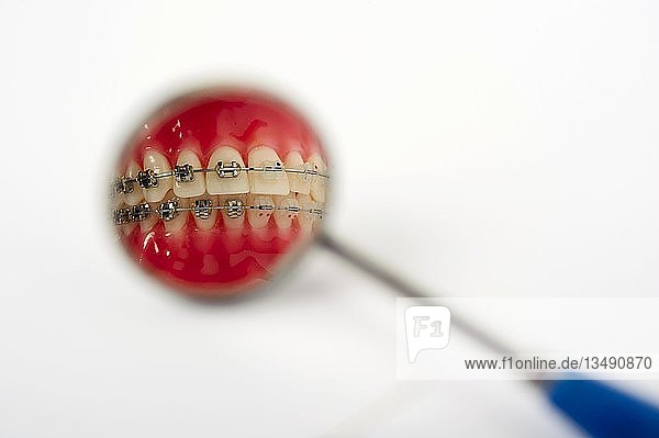 Zahnpflege  Gebiss mit fester Zahnspange  teilweise in einem Zahnspiegel reflektiert