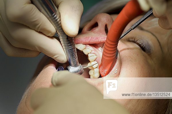 Zahnarzt entfernt Zahnkronen