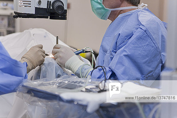 Chirurgische Technikerin  die das Auge spült  und Arzt  der während einer Kataraktoperation ein Phako mit einem Cracker-Instrument verwendet