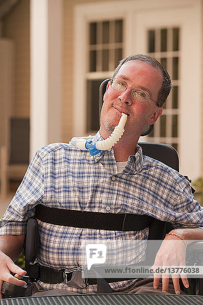 Man with Duchenne muscular dystrophy with a breathing ventilator