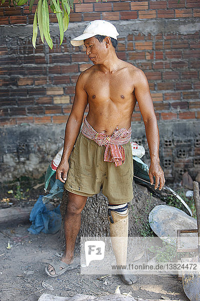 Opfer einer Landmine in Kambodscha