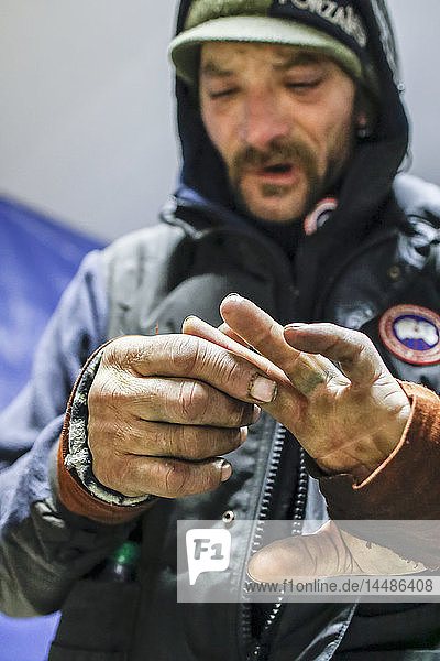 Lance Mackey zeigt seine erfrorenen Hände am Tanana-Kontrollpunkt während des Iditarod 2015
