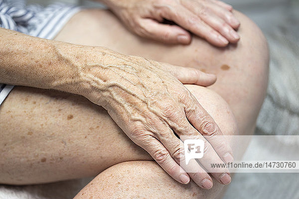 Hands with spots of old age