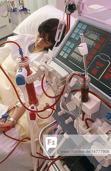 HEMODIALYSIS OF A WOMAN