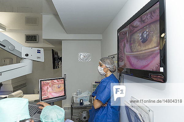 Reportage in der Klinik New Vision in Nizza  Frankreich. Diese Klinik ist eines der wichtigsten Zentren für refraktive Chirurgie in Frankreich und verfügt über die modernste Technologie für alle Augenlaseroperationen. Behandlung von Kurzsichtigkeit mit der Lasik-Technik. Der Femtosekundenlaser erzeugt eine Hornhautlamelle  die angehoben wird  so dass die tiefen Schichten der Hornhaut zugänglich sind. Diese Schichten werden dann durch die Wirkung des Excimer-Lasers (EX500 Alcon) neu modelliert. Sobald die Hornhaut neu modelliert ist  senkt der Chirurg den Flap ab und positioniert ihn wieder an seiner ursprünglichen Stelle.