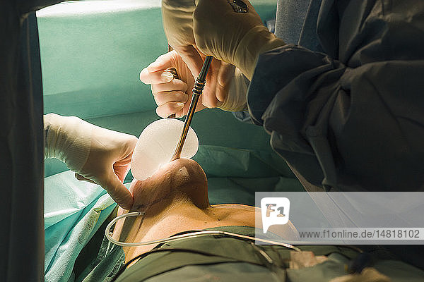 Reportage in the Mozart plastic surgery clinic in Nice France. Fitting breast implants using the round block technique. Placing the implant.