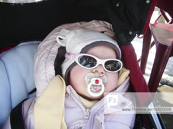 PHOTOPHOBIA IN AN INFANT