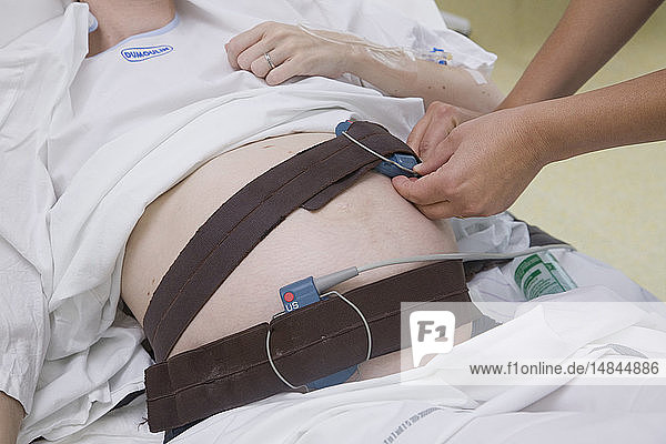 FETAL MONITORING