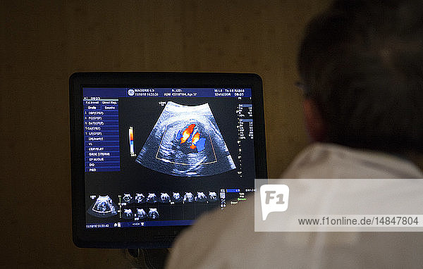 Reportage in einem radiologischen Zentrum in Haute-Savoie  Frankreich. Ein Radiologe führt eine Untersuchung im dritten Trimester durch. Der Blutfluss ist sichtbar.