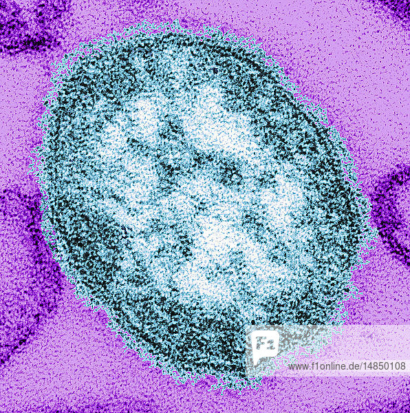 This thin-section transmission electron micrograph (TEM) revealed the ultrastructural appearance of a single virus particle or “virion of measles virus. The measles virus is a paramyxovirus of the genus Morbillivirus. It is 100-200 nm in diameter wit