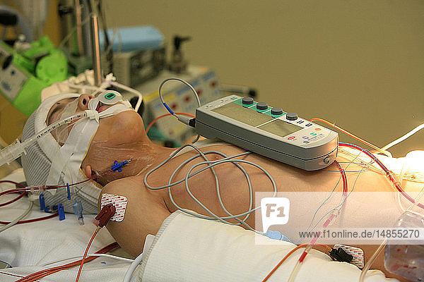 MONITORING A PACEMAKER