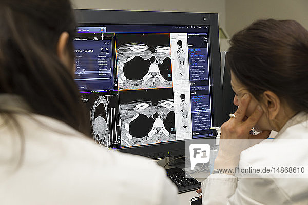 Reportage on PET imaging at the Antoine-Lacassagne Cancer centre in Nice  France. Positron Emission Tomography  or PET scan  is used in diagnosing and monitoring patients with cancer. This method enables tumours to be detected using a radioactive tracer  which accumulates heavily in cells that present a pathological hypermetabolism. The scintigraphy doctor interprets the results. Imaging from the whole body are looked at. No irregularity is visible on the screen.