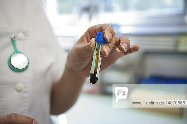 BLOOD SPECIMEN