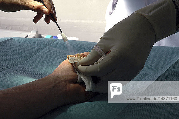 WOUND CARE