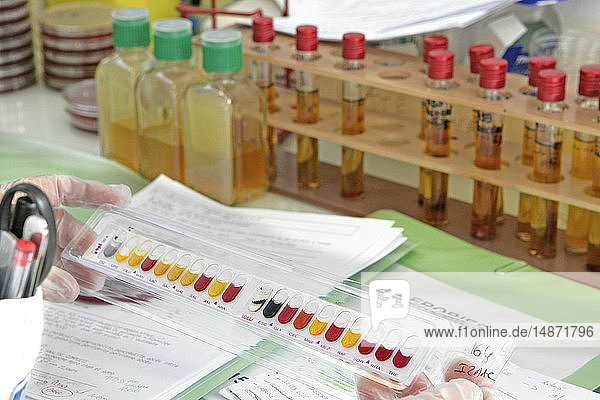 URINE TEST